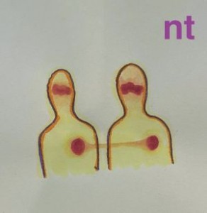Image of NT - NT